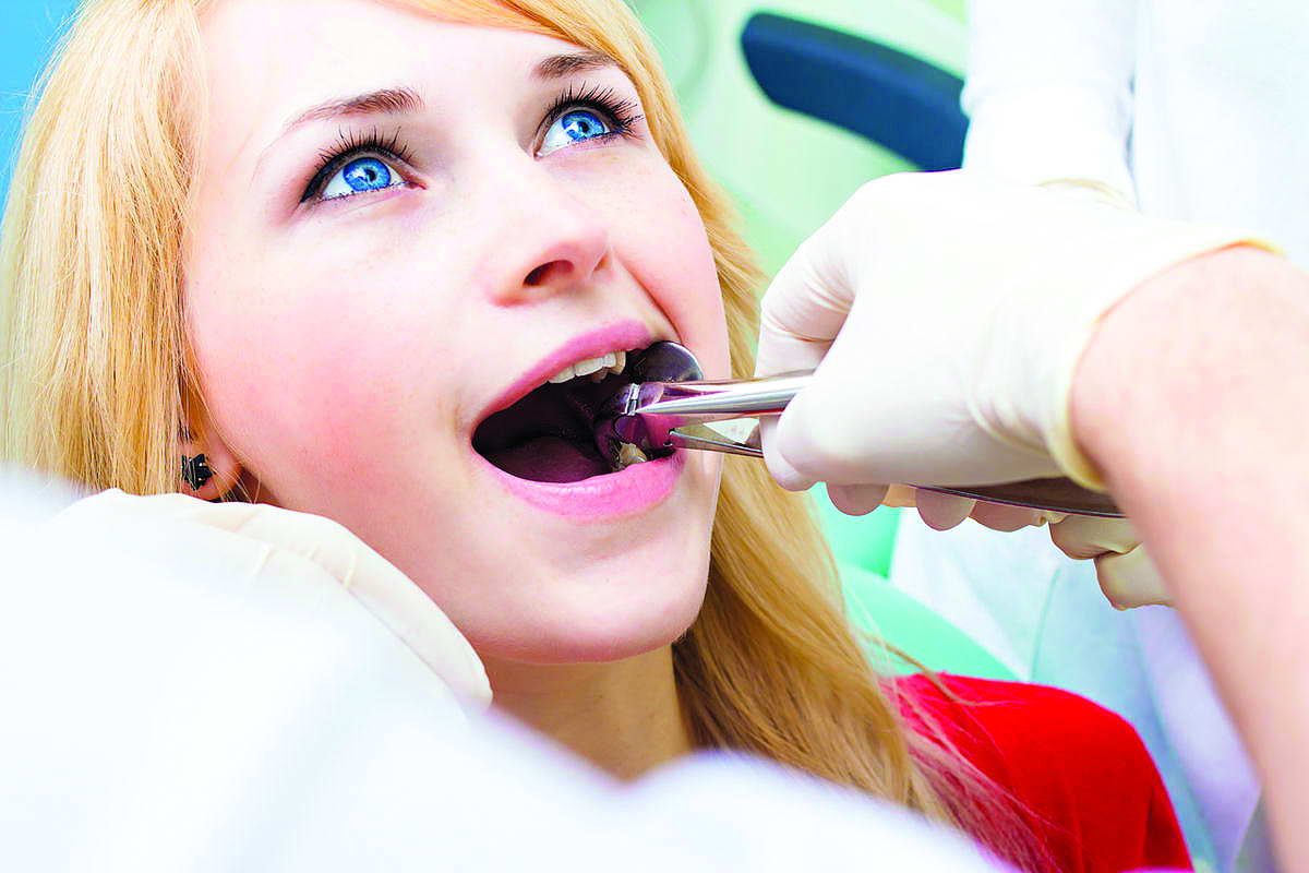Більшість пацієнтів після видалення зуба скаржаться лише на незначний дискомфорт. Фото Adobe Stock