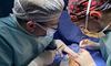 Львівські лікарі прооперували жінку з невідомою хворобою, яка спричинила деформацію пальців