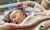 У Львові хірурги врятувати немовля з вродженою вадою легень