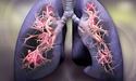 В Україні створили чат-бот про рак легень