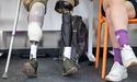 В Україні з’явиться польсько-український центр протезування для ветеранів