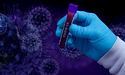 Новий підтип коронавірусу виявили у двох областях, зокрема на Львівщині