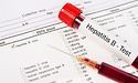 Коли швидкий тест може «не побачити» хронічного гепатиту В?