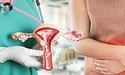 У Львові жінки зможуть безкоштовно прийти на огляд-профілактику раку шийки матки