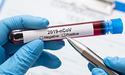 Уже скоро: вчені спрогнозували новий спалах коронавірусу в Україні