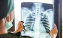 Туберкульоз легень — виліковний. За яких симптомів слід звернутися до лікаря?