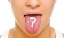 Пече язик… Що робити?