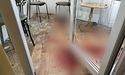 Росіяни поцілили по медзакладу Херсона: загинув лікар, поранено медсестру