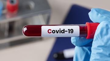 Україна – друга у світі за добовою смертністю від коронавірусу