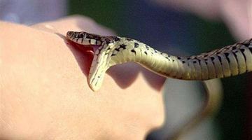 Укус змії. Фото ілюстративне