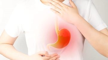 Кислота, яка є в шлунку, допомагає травити їжу, яка туди потрапляє. Кислота, яка закидається у стравохід, провокує печію. Фотоколаж Rivas Digestive Center.
