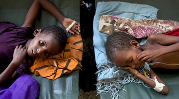 У Східній Африці голодують щонайменше 13 мільйонів людей. Фото commons.com.ua