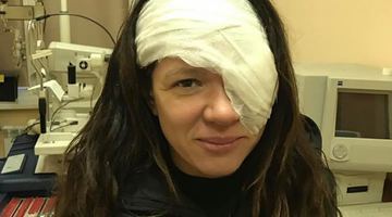 Руслана показала наслідки операції на оці