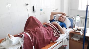 Допомогти в лікуванні поранених: глава МОЗ Німеччини прибуде в Україну