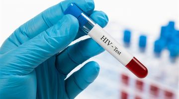 У львівських поліклініках, амбулаторіях та лікарнях можна зробити безкоштовне експрес-тестування на ВІЛ-інфекцію. Фото із мережі