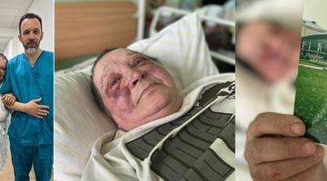 У Херсоні окупанти зламали хребет журналістці: жінка не віддавала українського паспорта
