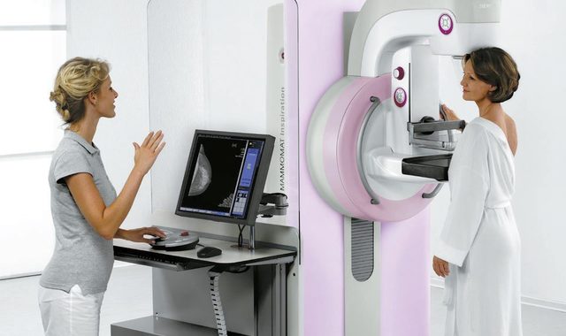 Після 40 років треба проходити мамографію