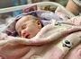 У Львові хірурги врятували немовля з вродженою вадою легень